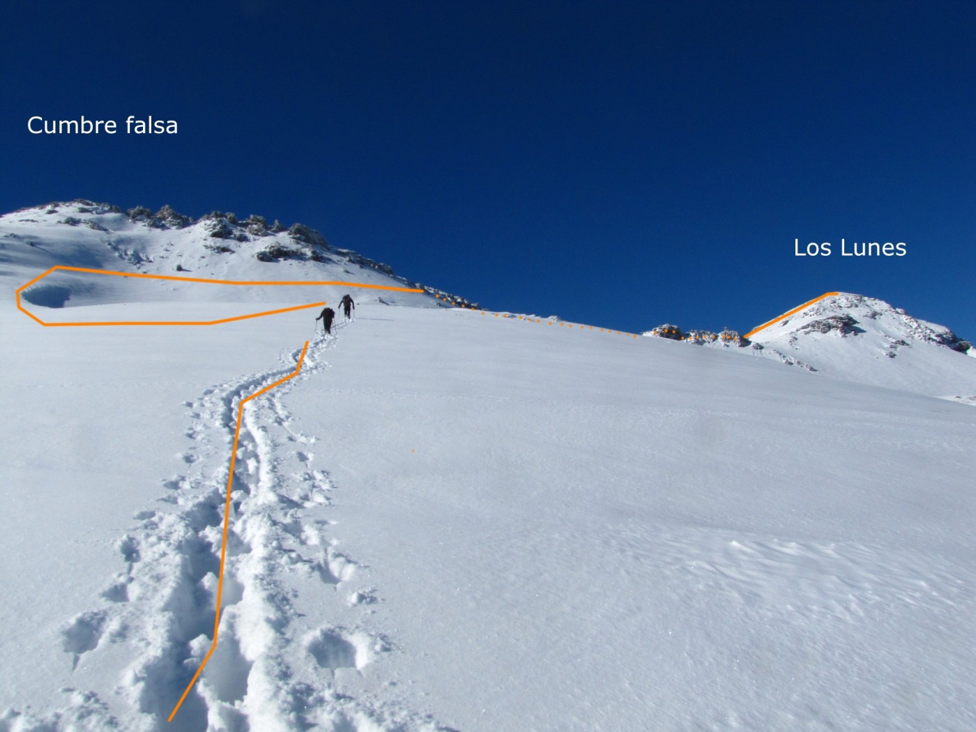 Normal desde el Yeso