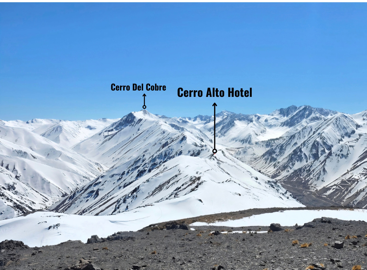 Cerro Alto Hotel